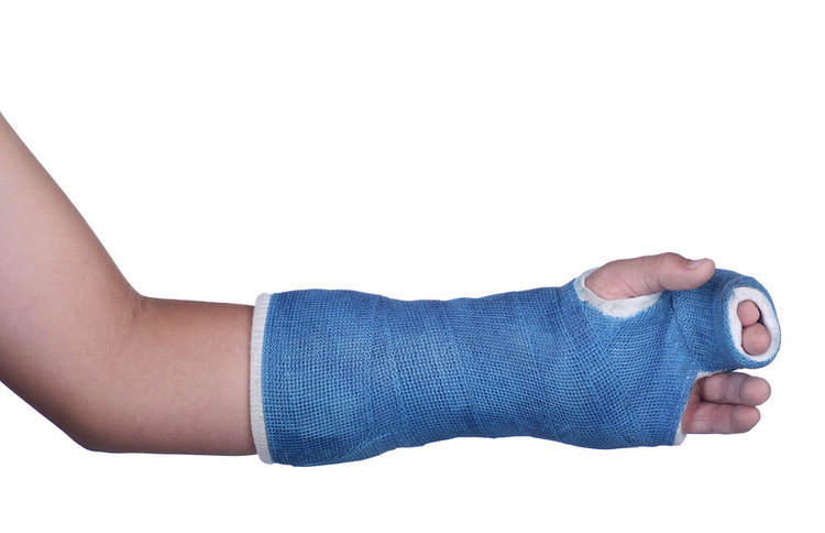 Arm in cast